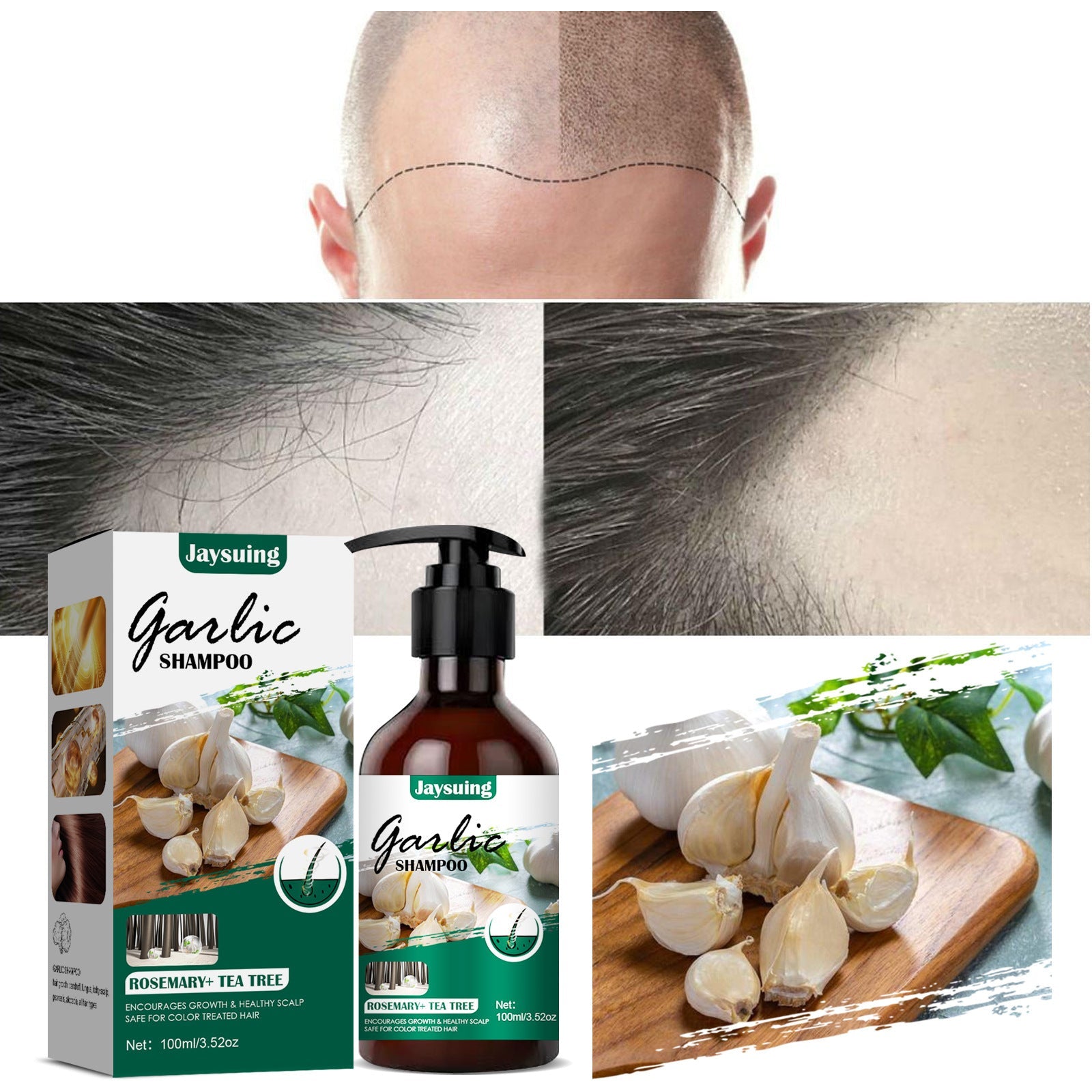 Garlic Shampoo – Botanical HairRepair Formula
