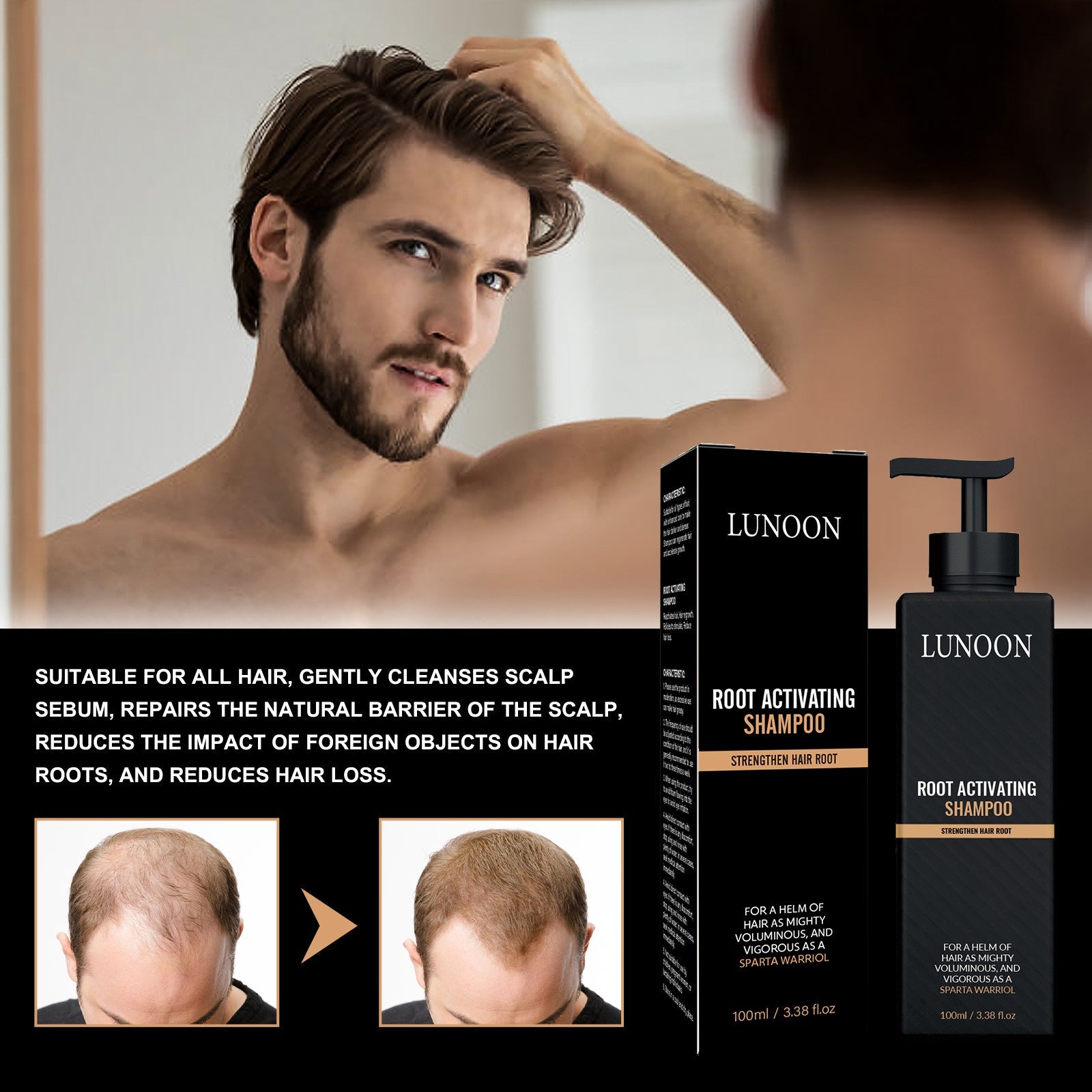 LUNOON™ Root Activating Shampoo