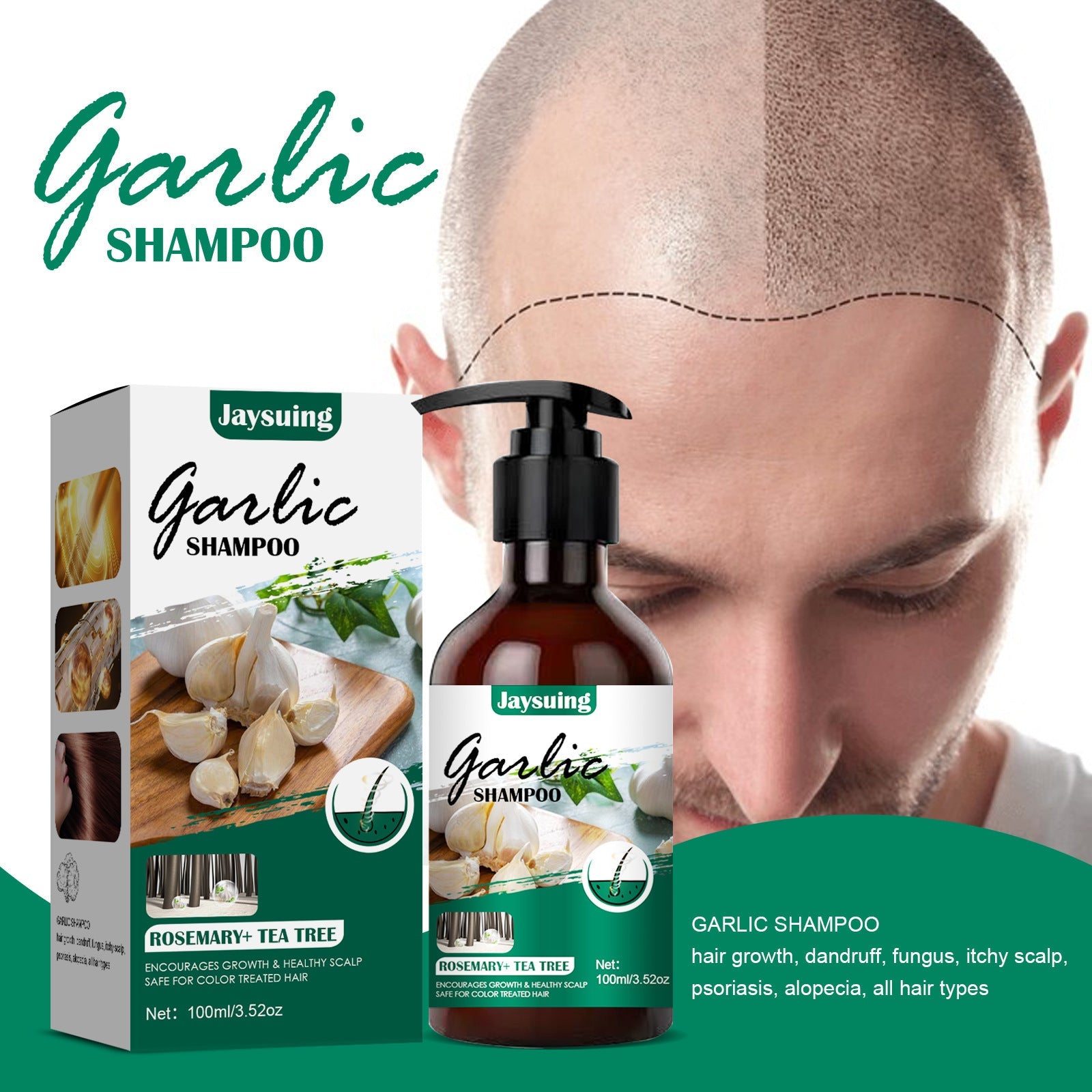 Garlic Shampoo – Botanical HairRepair Formula